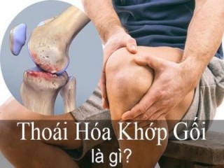 Tại sao người bị thoái hóa khớp gối nên sử dụng Hoàng Thấp Linh