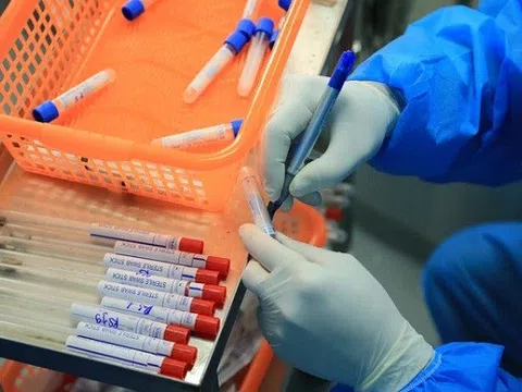 Vaccine phòng dịch tả lợn châu Phi do Việt Nam sản xuất đã sẵn sàng ra thị trường