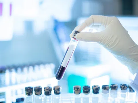 Xét nghiệm máu phát hiện sớm đa ung thư của Công ty Grail trên lộ trình xin được FDA cấp phép