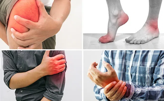 Bài thuốc chữa bệnh khớp của lương y phố núi Phạm Trọng Hùng