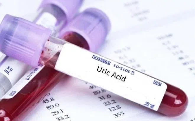 Bật mí cách giảm axit uric máu an toàn, hiệu quả từ thảo dược thiên nhiên